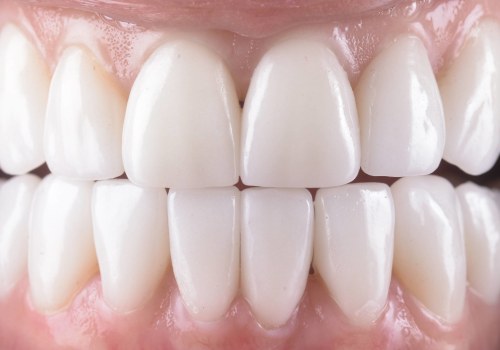 Preventing Further Damage: How Restorative Dentistry Can Improve Your Oral Health